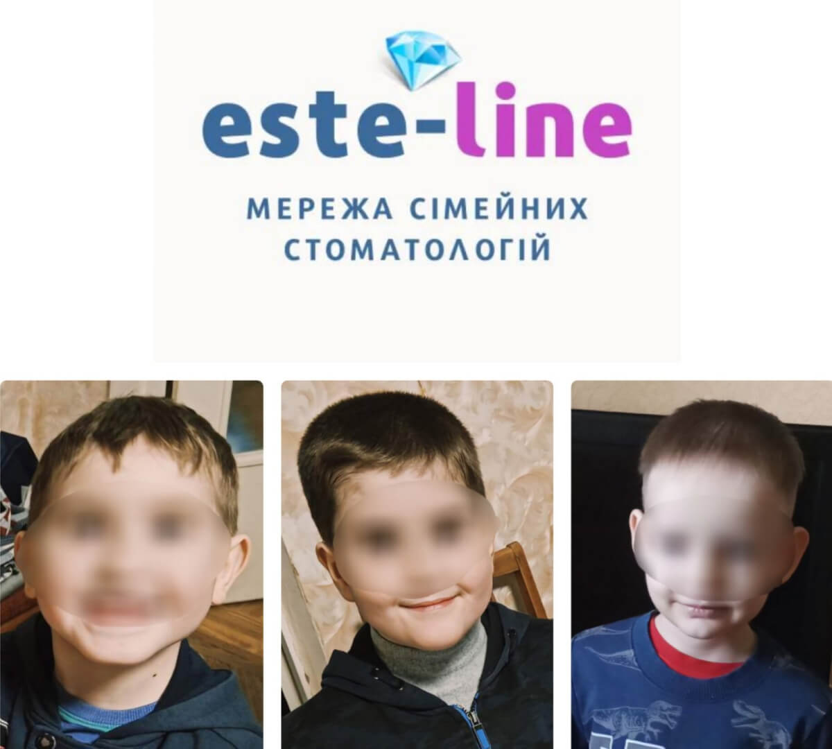 стоматологічне лікування в стоматології “ESTE LINE”