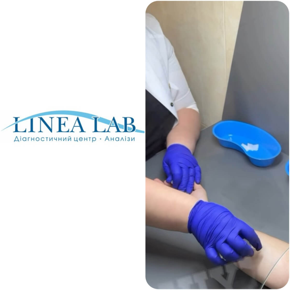 Діагностика в “Linea.lab” (english version below)
