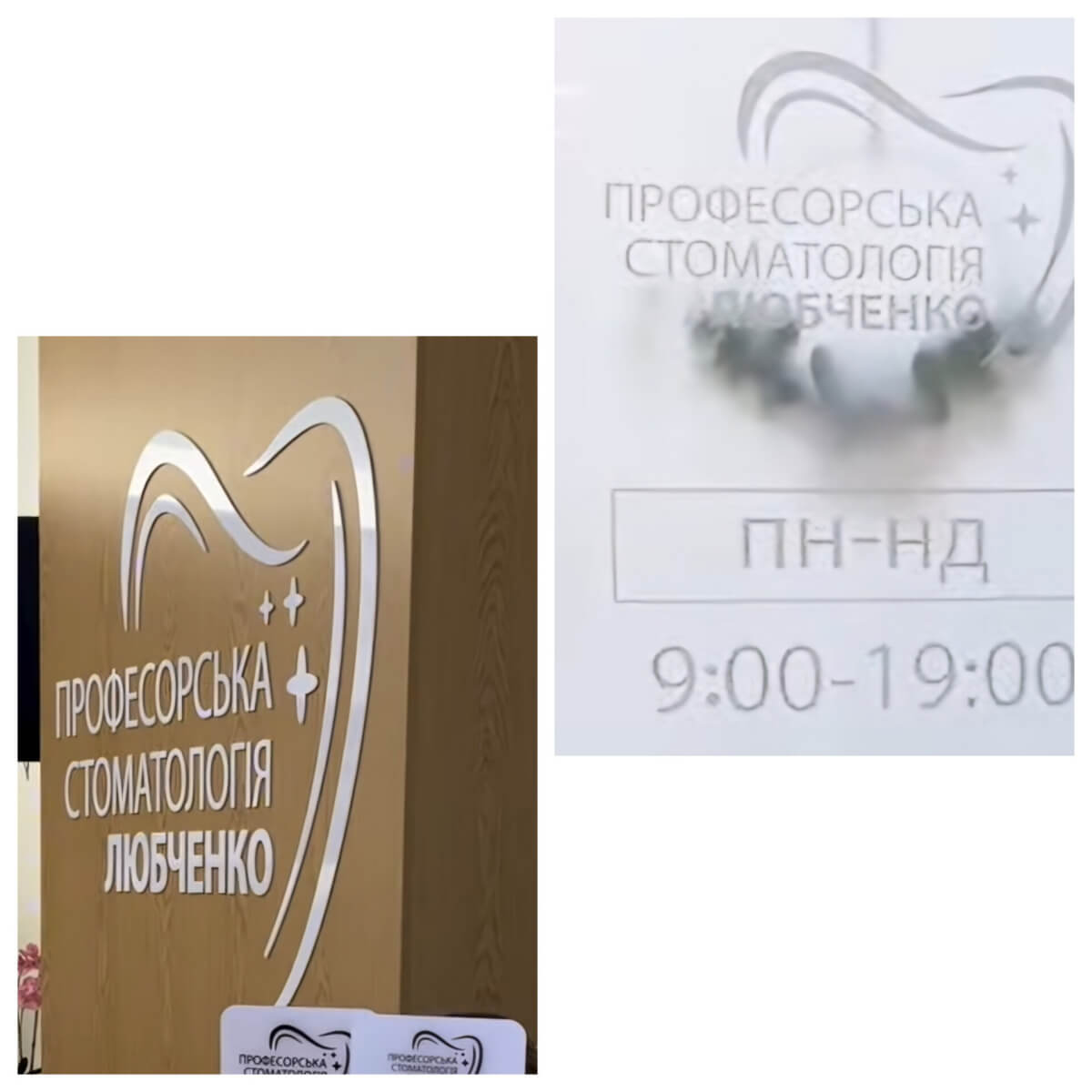 Стоматологічне відновлення зубів дівчаток, повернутих з ТОТ